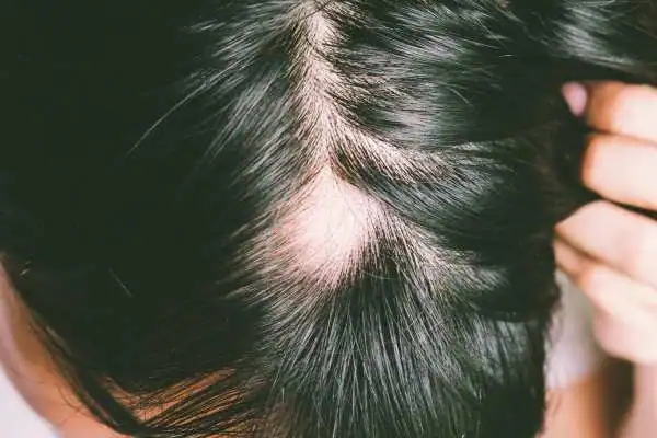 Role of PTD-DBM and GHK-Cu in Stimulating Hair Growth